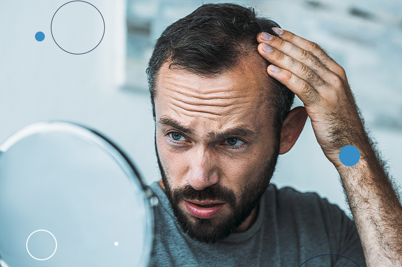 Tipos de cabelo masculino: tem diferença? Entenda!