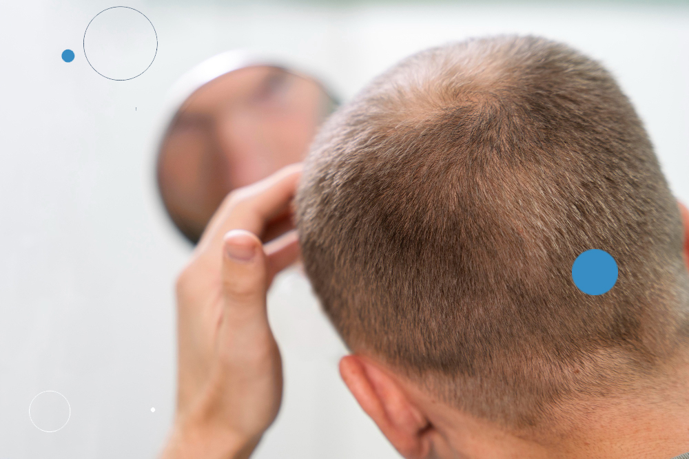 O que devo fazer quando o cabelo está caindo muito? O que pode ser? Como  acabar c/ a queda capilar? 