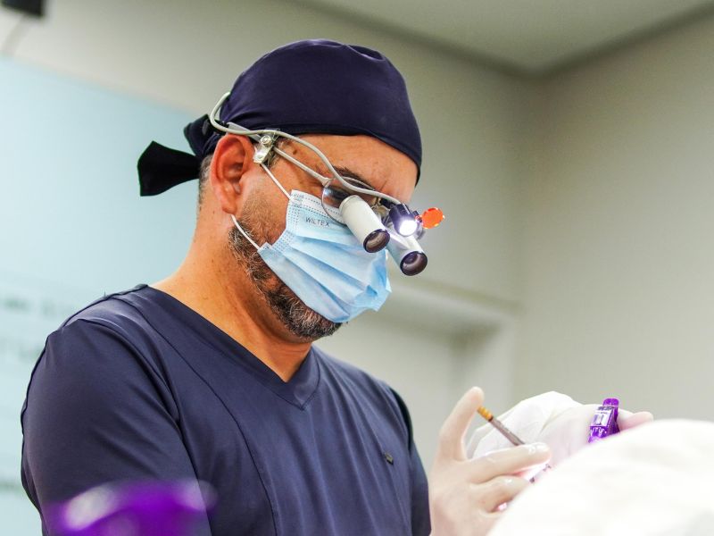 transplante capilar barba antes e depois etapas