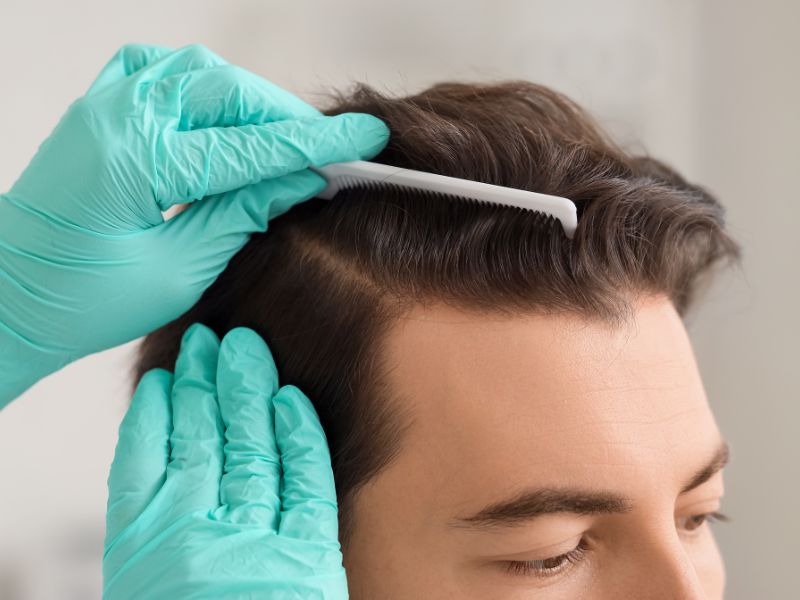 como é feito o implante capilar técnica